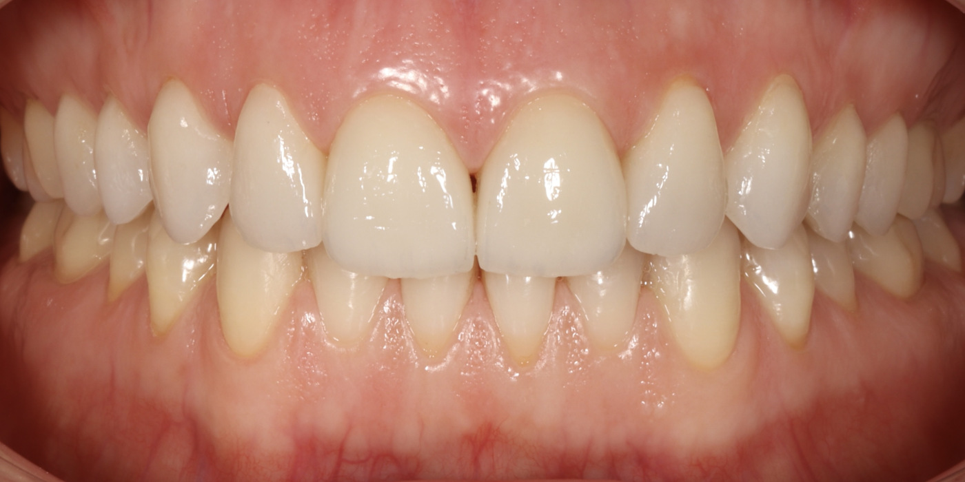 După – estetică dentară, Clinica Brânzan