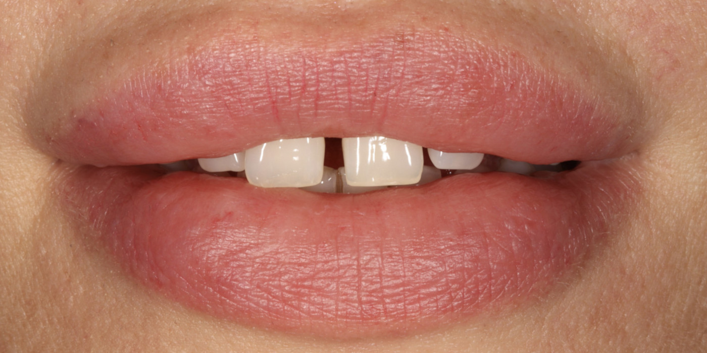 Înainte – estetică dentară, Clinica Brânzan